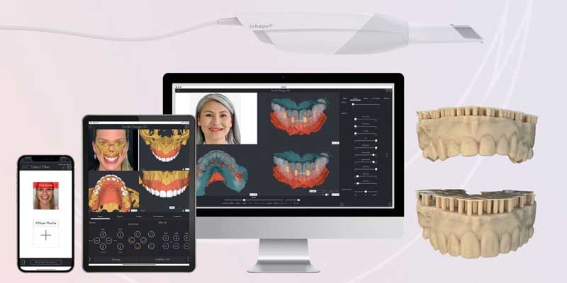 کاشت دندان به روش دیجیتال | ایمپلنت دیجیتال